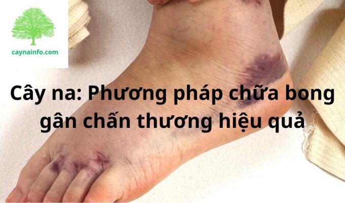 Cây na: Phương pháp chữa bong gân chấn thương hiệu quả